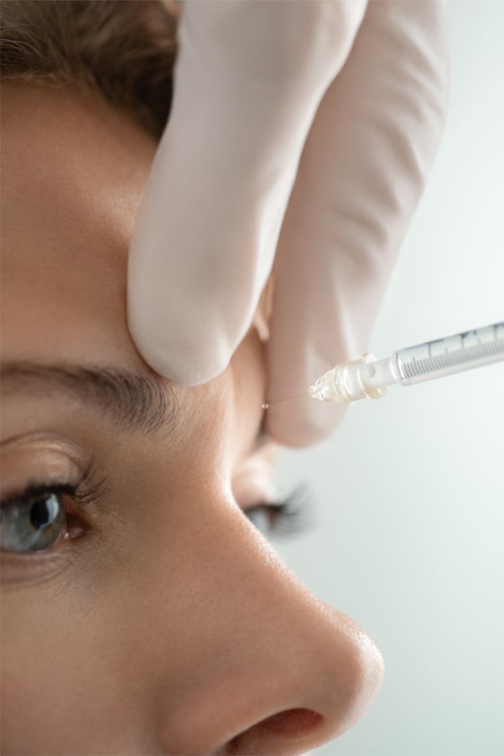 Injectie bij de wenkbrauw